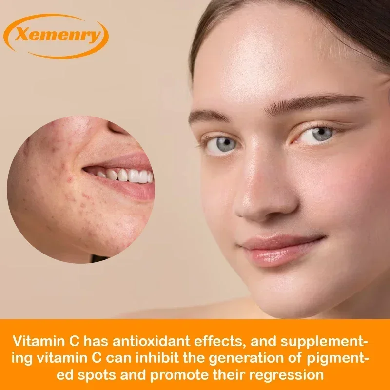 Vitamin C Capsules 1000mg - Im - Zinc Supplement 50Mg review and price